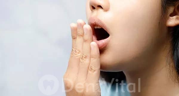 Ağız Kokusu (Halitosis) Tedavisi