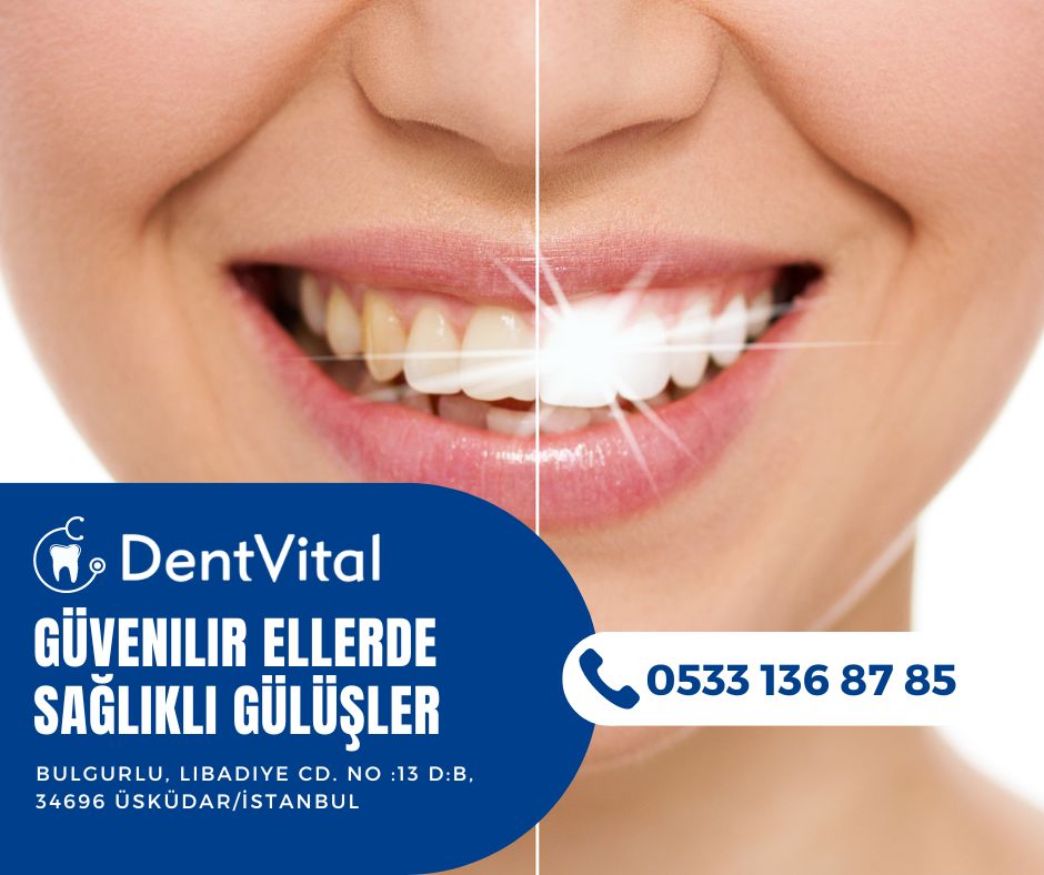 DentVital Hakkımızda Banner