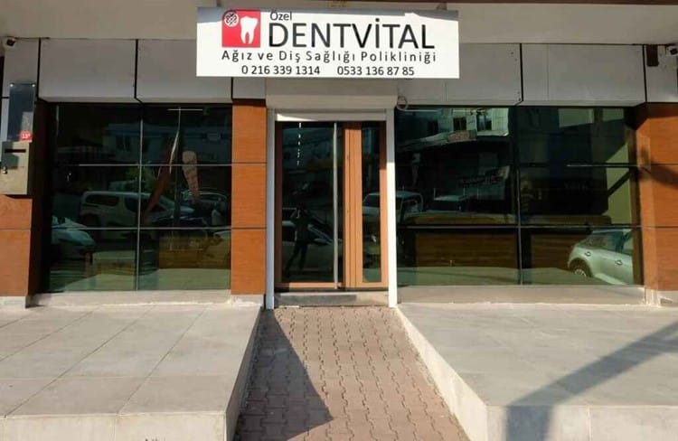 Üsküdar'da Diş İmplantı Yaptırmanın Maliyeti
