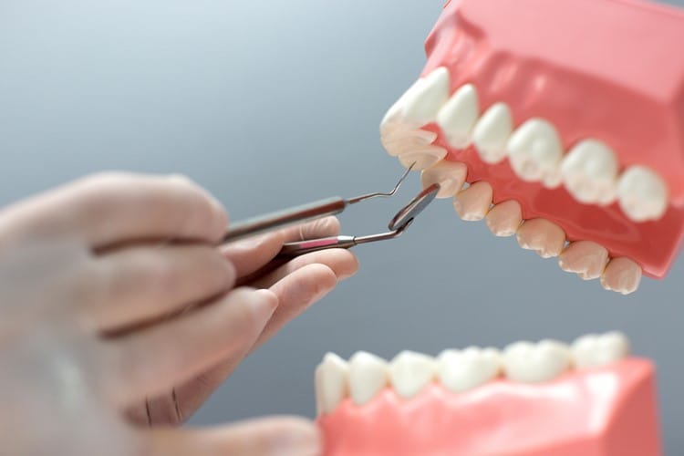 Acil Diş Tedavisine İhtiyacım Var mı? Belirtiler ve Çözümler