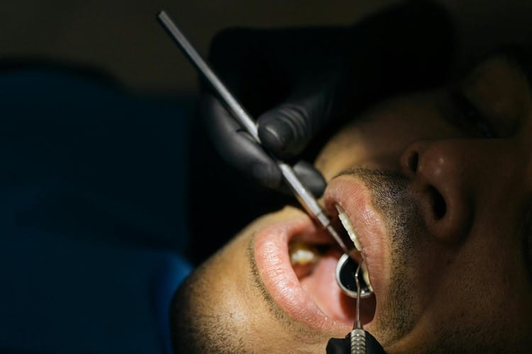 Diş Lekeleri Nasıl Geçer: En Etkili Yöntemler ve Önlemler 2 Dişlerinizdeki Lekelere Kalıcı Çözüm İçin DentVital Yanınızda