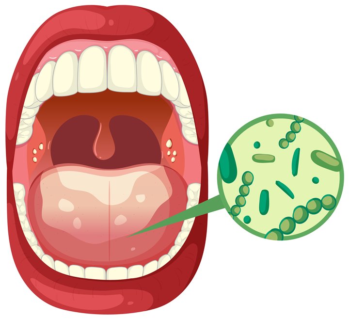 Ağız Bakterileri Nasıl Öldürülür? 1 Ağız Bakterileri Nedir ve Neden Oluşur?