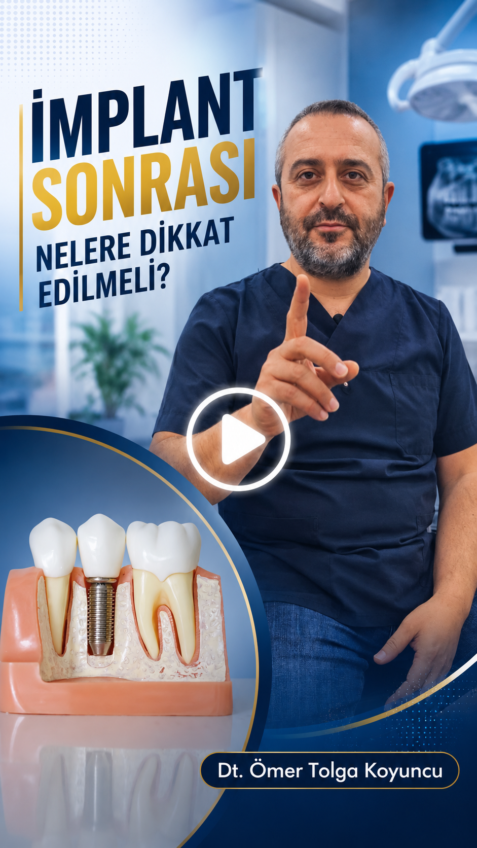 DentVital 25 İmplant sonrası nelere dikkat edilmeli?