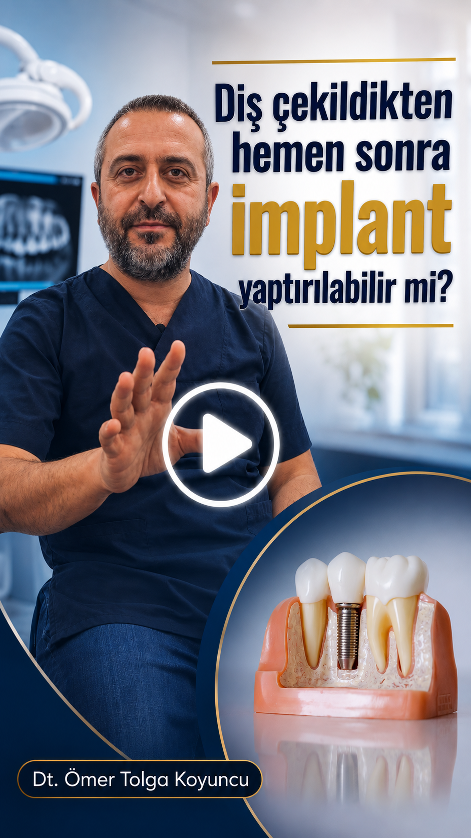 DentVital 26 Diş çekildikten hemen sonra implant yaptırılabilir mi? Diş Hekimi Ömer Koyuncu yanıtladı