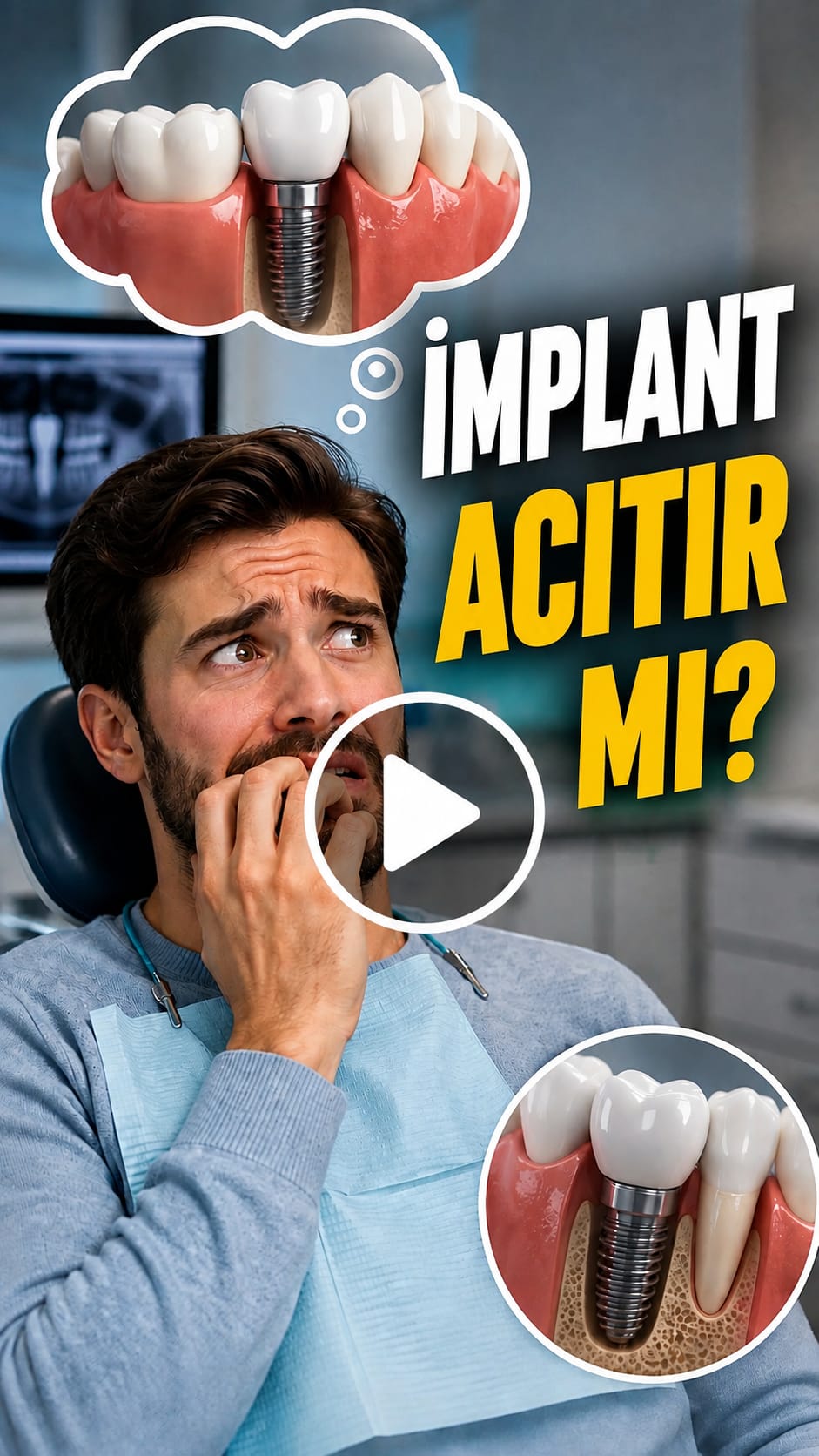 DentVital 25 İmplant acıtır mı?