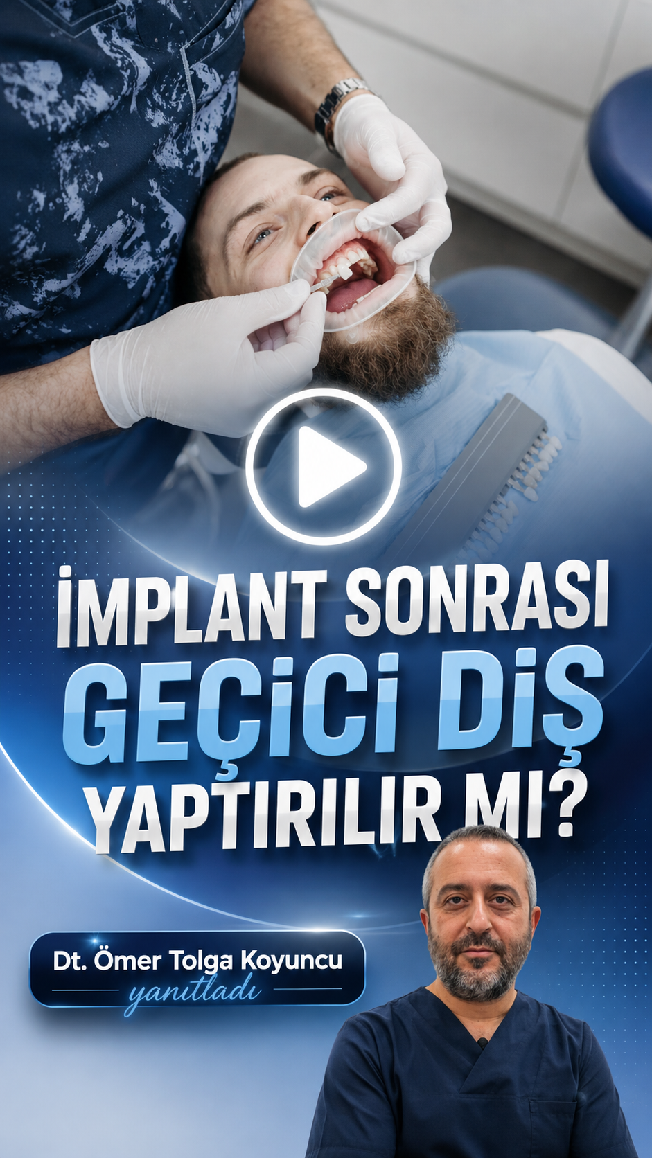 DentVital 25 implant sonrası geçici diş yaptırılır mı? #implant #uskudar