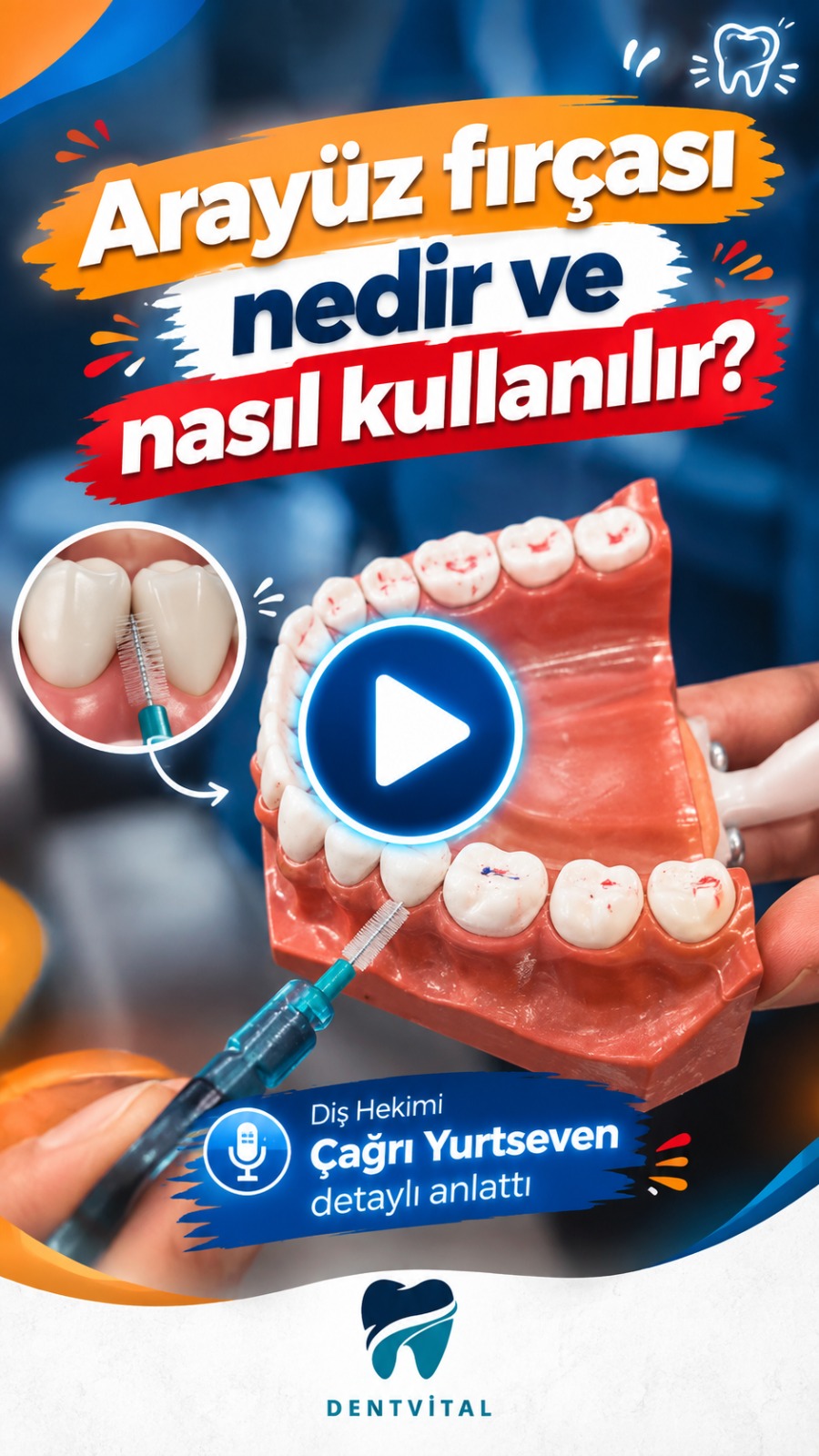 DentVital 25 Arayüz fırçası nedir ve nasıl kullanılır? Dt. Çağrı Yurtseven anlattı #dişfırçalama