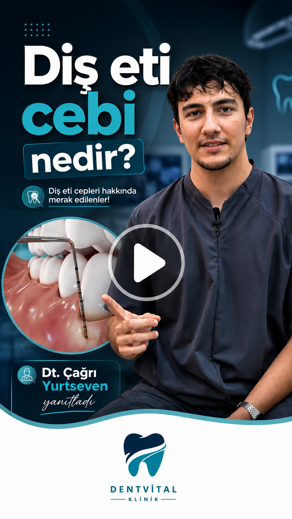 DentVital 25 Diş eti cebi nedir?