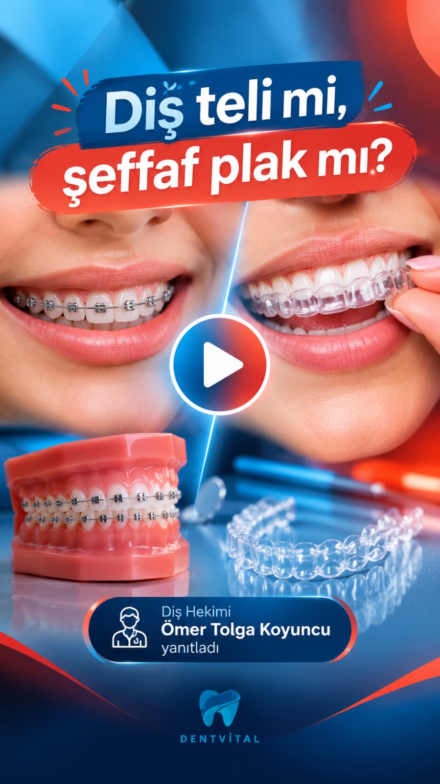DentVital 25 Ortodonti tedavisinde diş teli mi, şeffaf plak mı tercih edilmeli?